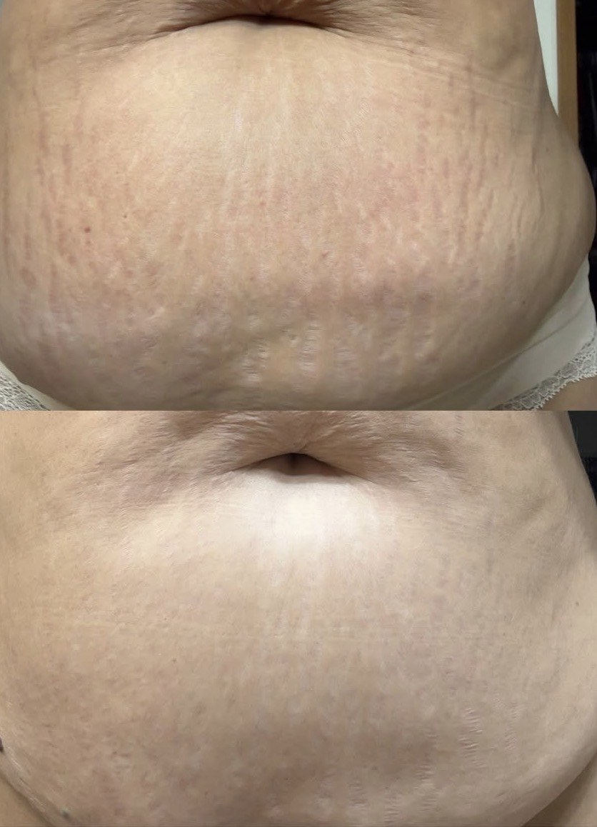 Healed results placeholder
